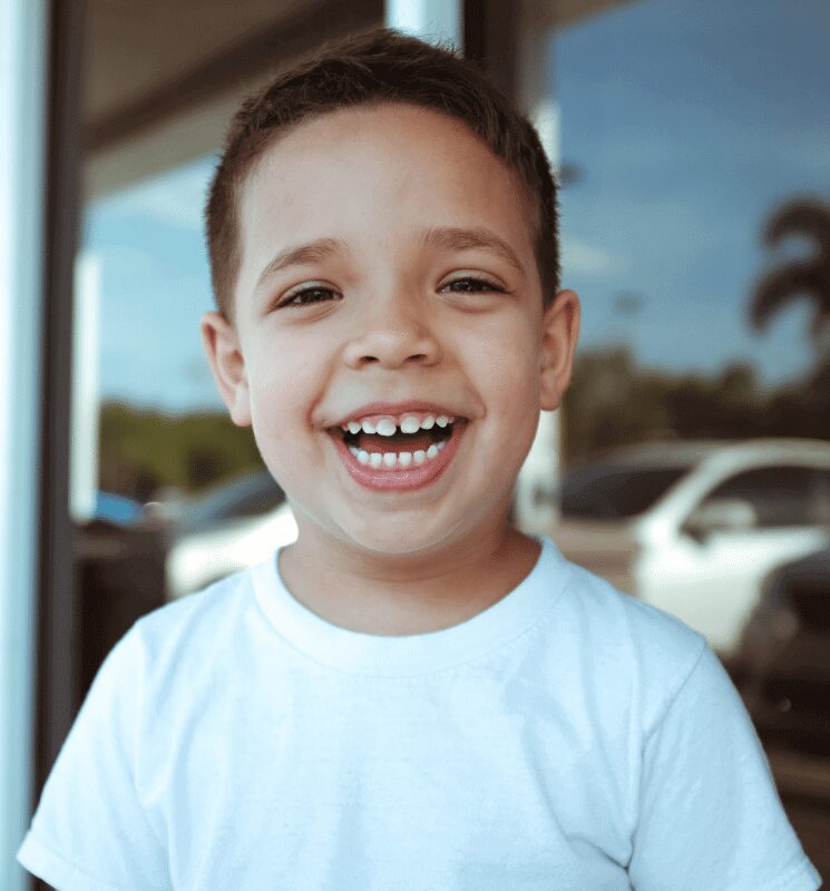 frenectomy dentist Lexington KY