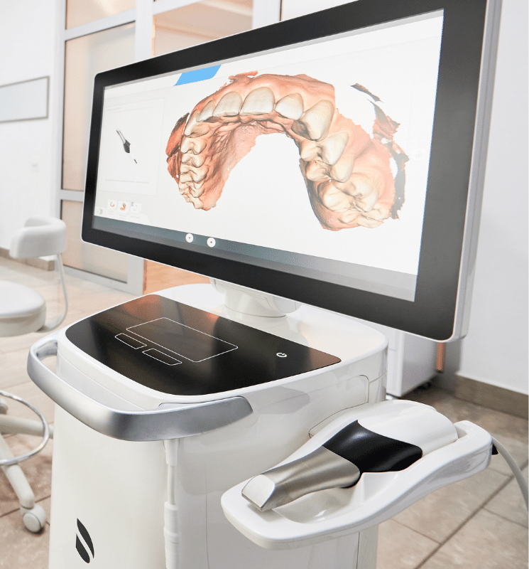 intraoral scanner - Lexington KY dentist