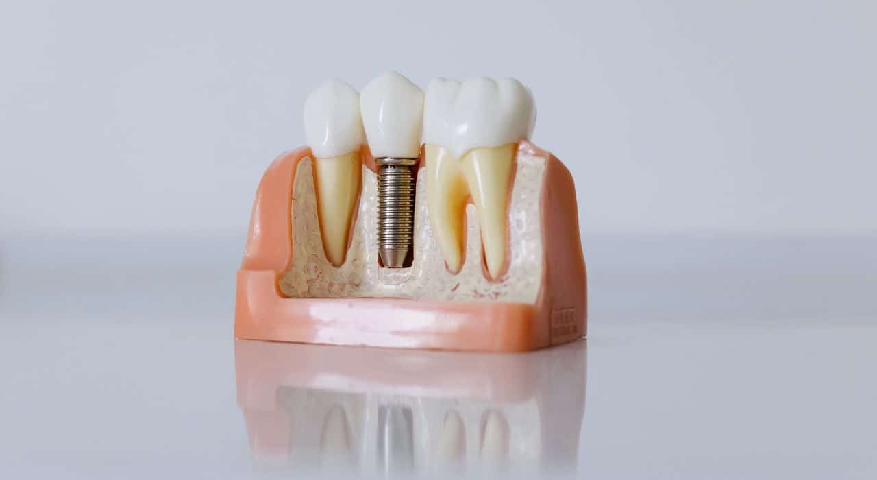 Understanding Restorative Dentistry